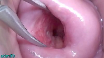 asian wifey Open Cervix wide to witness inside Uterus